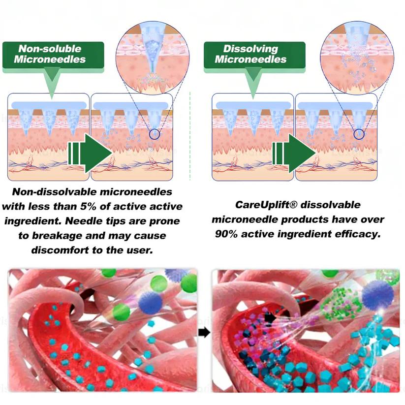 💚Official Store | 🍋 Aetherium™ Moringa & Berberine 10-IN-1 Advanced Nano Microneedle 1 Patch (Once Daily, visible changes in 7 days) ✅ Obesity, Diabetes, Sleep Apnea, And Joint Issues